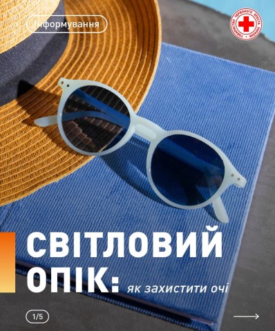 Світловий опік: як захистити очі, - поради від Червоного Хреста України