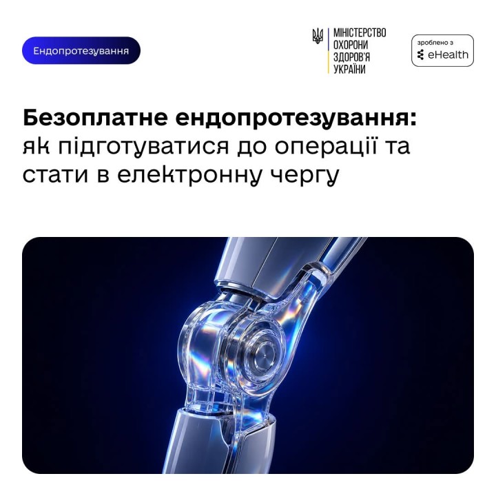 Безоплатне ендопротезування: як підготуватися до операції та стати в електронну чергу