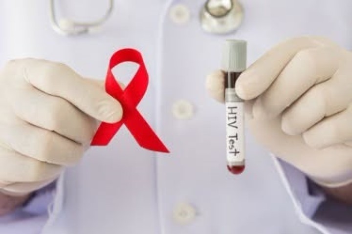У серпні в Києві зареєстрували 54 нові випадки ВІЛ-інфекції